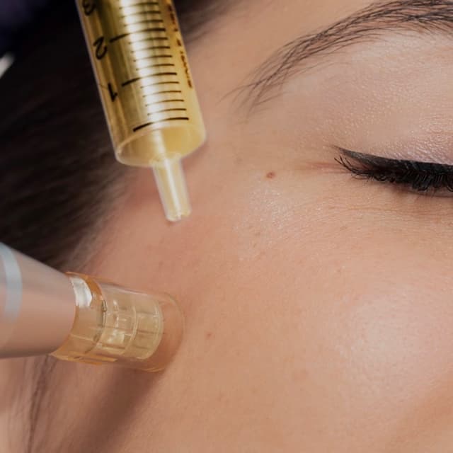 Liquid Gold PRP Facial at Spatium Urgent Care & Wellness in Marietta, GA