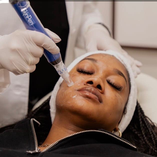 Microneedling Package at Spatium Urgent Care & Wellness in Marietta, GA