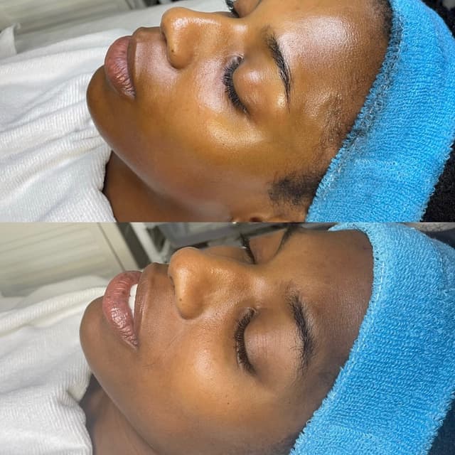 Signature Glow facial at Spatium Urgent Care & Wellness in Marietta, GA